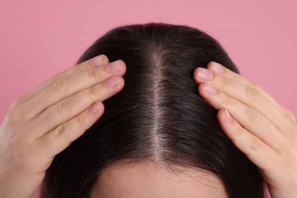 A close-up of a person's scalp with dark hair parted down the middle, as their hands gently hold the hair back to reveal the scalp. The clear view of the scalp suggests a focus on scalp health or treatments like exfoliation.