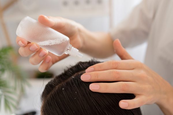 Applying lightweight scalp care treatment to the hairline