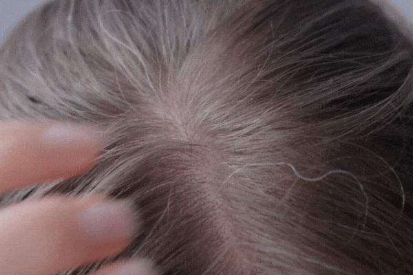 Close-up view of a person's scalp showing hair parted to reveal the roots. Fingers gently move the hair to expose the skin beneath, illustrating where pigment-producing melanocytes reside within hair follicles.