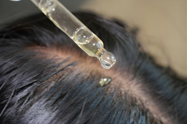 How to Use Hair Growth Oils Effectively A close-up of a dropper applying oil directly onto a person's scalp with dark, parted hair. The clear, golden oil drop is mid-air, emphasizing scalp treatment as part of a hair care routine using one of the best hair growth oils.