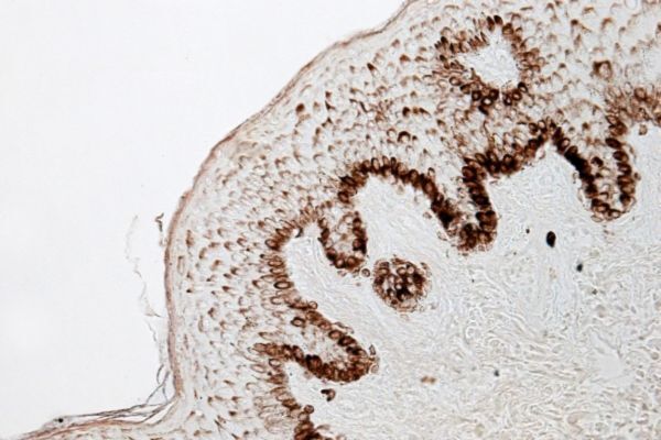 This image shows a cross-section of human skin tissue under a microscope, highlighting the melanin production in hair follicles. The dark brown pigment concentrated in the follicle's inner layers represents melanogenesis — the biological process that produces melanin, responsible for hair color.