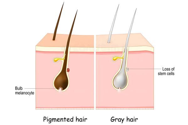 Illustrated cross-section comparing pigmented hair and gray hair follicles. The left side shows dark hair with active bulb melanocytes, while the right side shows gray hair due to a loss of stem cells, highlighting the biological cause of hair color change.